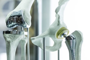 Prótesis de rodilla