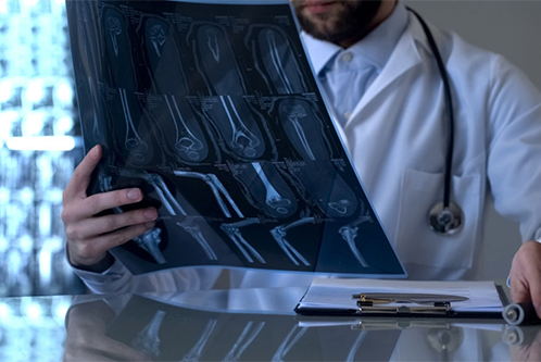 Ortopedista traumatólogo